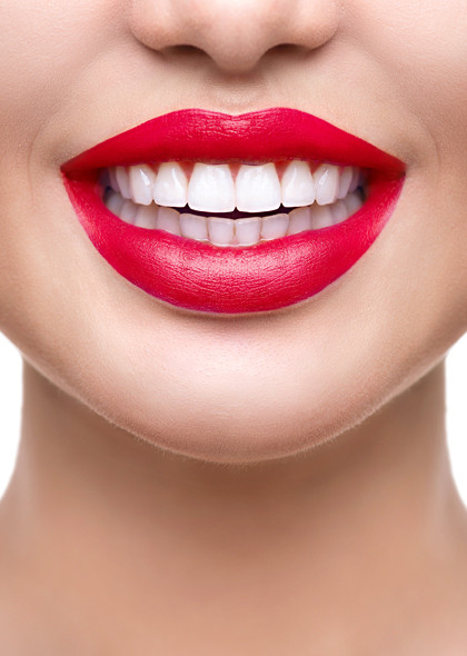 Porcelain Veneers